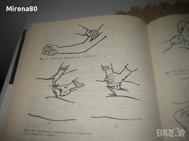 Хирургия - 1982 г., снимка 6 - Специализирана литература - 53529082