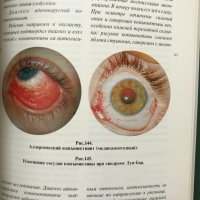 Глазные болезни - aтлас, снимка 5 - Специализирана литература - 28598504