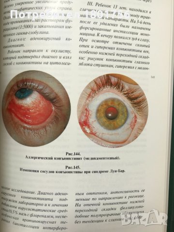 Глазные болезни - aтлас, снимка 5 - Специализирана литература - 28598504