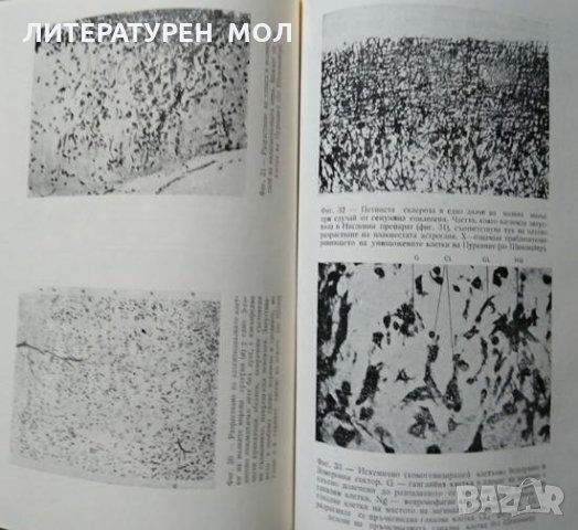 Клинична психиатрия. Част 1 Никола Шипковенски 1956 г., снимка 3 - Специализирана литература - 27590219