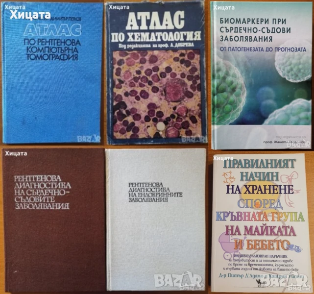 Биомаркери;Рентгенова компютърна томография,Хематология;Рентг. диагн.сърдечно-съдовите,ендокринните , снимка 1