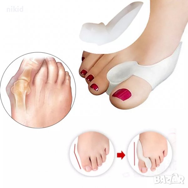 2 бр силиконови шини фиксатор ортеза ортези изправяне на пръсти палци изпъкнало кокалче палеца крака, снимка 1