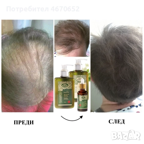 Маска активатор на растежа „Bio Rehab“, 250 гр, снимка 2 - Продукти за коса - 52716805