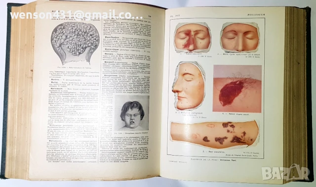 LAROUSSE MEDICAL ILLUSTRE, снимка 7 - Специализирана литература - 51321477