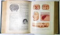 LAROUSSE MEDICAL ILLUSTRE, снимка 7