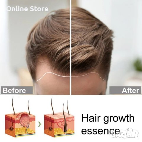 Многофункционален продукт за коса – растеж, заздравяване и сгъстяване, снимка 10 - Продукти за коса - 43011077