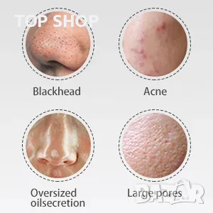 ANLAN Ултразвуков скрубер/ шпатула за кожа 4 в 1, снимка 6 - Козметични уреди - 48507979