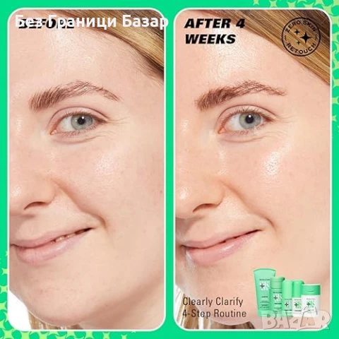 Нов Revolution Серум с 10% Ниацинамид за Пори и Акне 30мл Веган козметика, снимка 3 - Други - 51186373