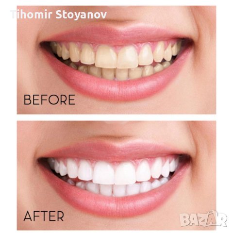 Пяна за избелване на зъби, снимка 5 - Други - 40337645
