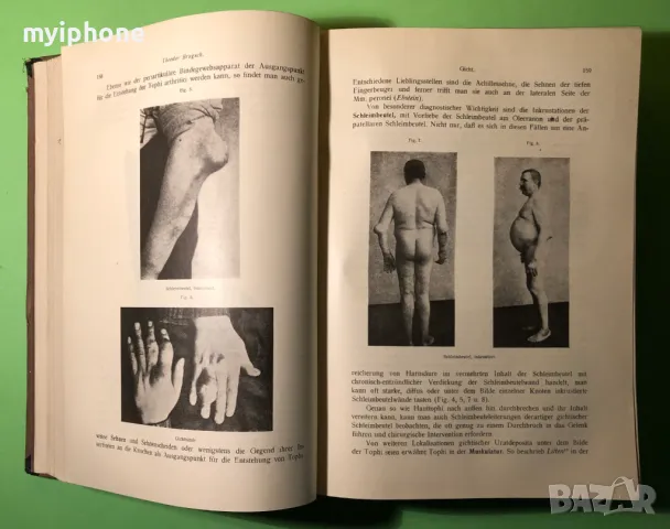 Стара Книга Болести на Обмяната Болести на Жлезите с Вътрешна секреция, снимка 4 - Специализирана литература - 49204935