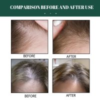 Многофункционален спрей за коса – растеж, заздравяване и сгъстяване, снимка 4 - Продукти за коса - 43059968