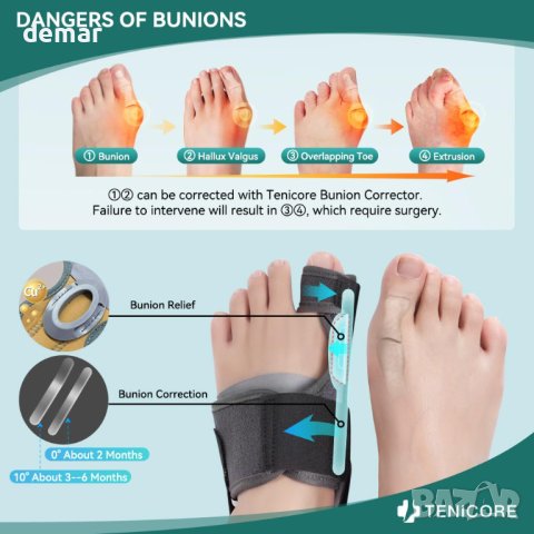 TENICORE Регулируеми шини за изправяне на пръстите на краката - 1 чифт, снимка 5 - Други - 43763429