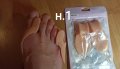 Изпъкнали кокалчета ”hallux valgus”-различни видове, снимка 4