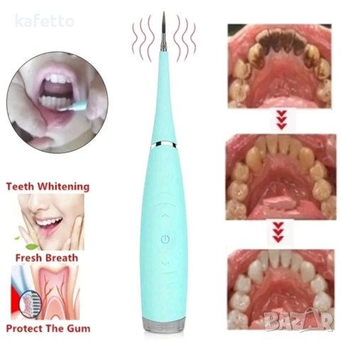 Нов ултразвуков апарат за почистване на зъбен камък, снимка 6 - Преси за коса - 44042169