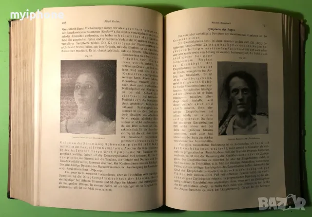 Стара Книга Болести на Обмяната Болести на Жлезите с Вътрешна секреция, снимка 7 - Специализирана литература - 49204935