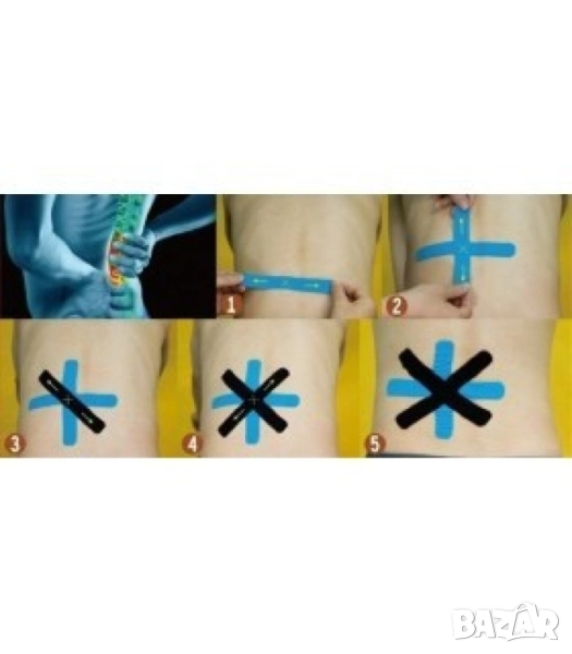 Лента за бързо възстановяване след травми , снимка 1