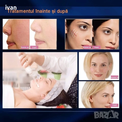 апарат дарсонвал - козметичен уред за озонотерапия , снимка 6 - Други - 53306068