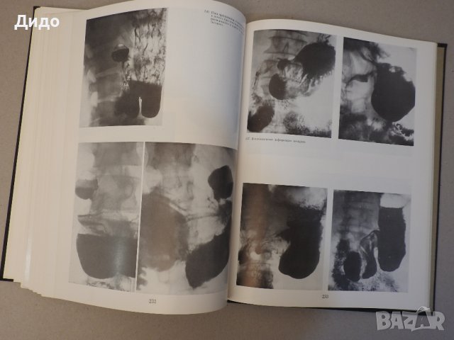 Рентгенодиагнистический атлас. Том 2: Болезни внутренних органов, снимка 9 - Специализирана литература - 39227598