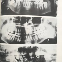 Атлас по стоматологична рентгенология - Димитър Маджаров, снимка 4 - Специализирана литература - 28596349
