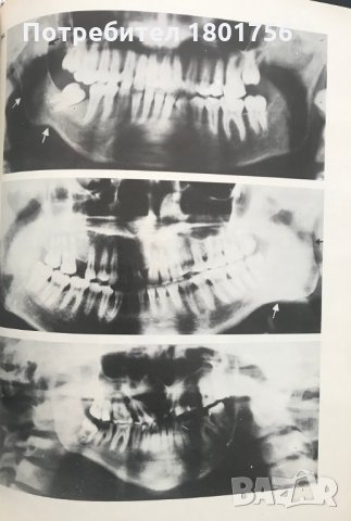 Атлас по стоматологична рентгенология - Димитър Маджаров, снимка 4 - Специализирана литература - 28596349