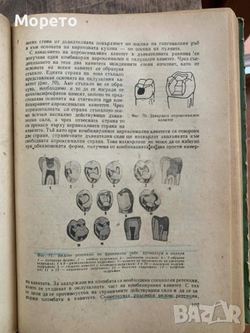 Терапевтична стоматология-Димитър Свраков, снимка 10 - Специализирана литература - 52863831