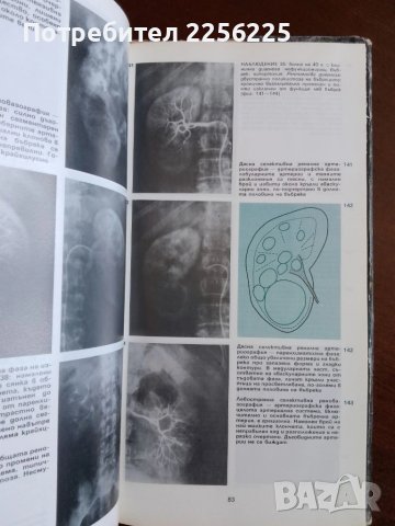 Ангиографски атлас на бъбречните заболявания, снимка 4 - Специализирана литература - 50695034