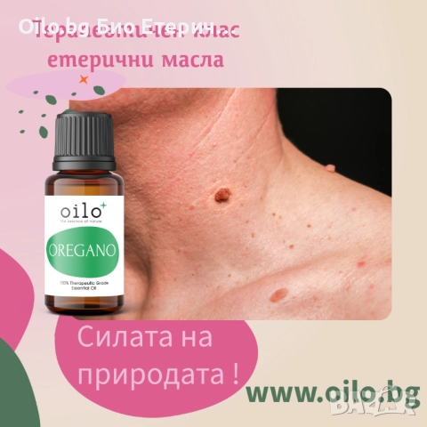 Вълшебството на ригана в бутилка + изненада за вас! ✨🌿Етерично масло терапевтичен клас Origanum vul, снимка 3 - Хранителни добавки - 52062994
