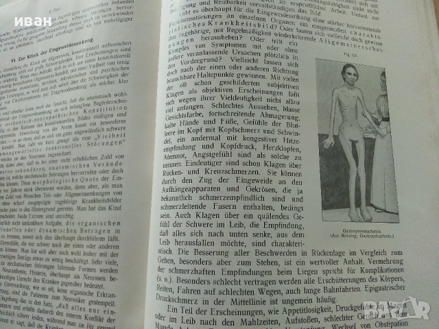 Die Chirurgie - Band V- Kirschner, M. und O. Nordmann - 1927 г., снимка 9 - Антикварни и старинни предмети - 36460717