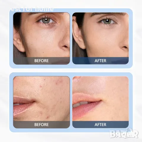 Ултразвукова машина за грижа лице и тяло  RU 628 Supersonic, снимка 7 - Козметика за лице - 47326330