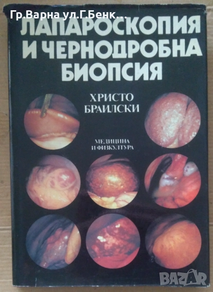 Лапароскопия и чернодробна биопсия  Христо Браилски 15лв, снимка 1