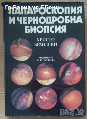 Лапароскопия и чернодробна биопсия  Христо Браилски 15лв