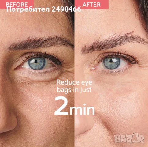 Remescar намалява торбичките и тъмните кръгове до & 75%