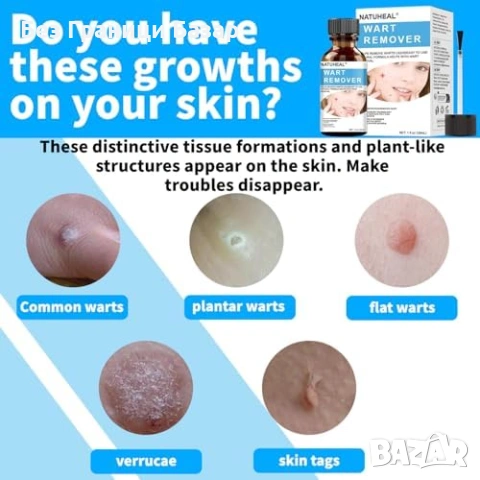 Нов Разтвор за брадавици кожни тагове мазоли калуси 30 мл бърз ефект, снимка 2 - Други - 53391118