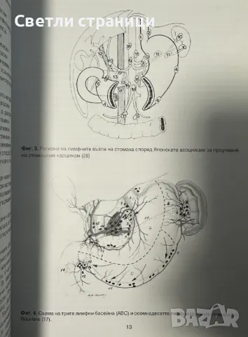 Рак на стомаха - класификация и лечение доц. Т. Сталийски, снимка 3 - Специализирана литература - 48270503