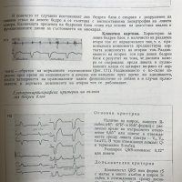Ритъмни нарушения на сърдечната дейност Клинична картина и лечение А. Томов, И. Томов, снимка 6 - Специализирана литература - 28598710