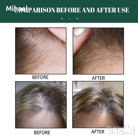 Многофункционален продукт за коса – растеж, заздравяване и сгъстяване, снимка 5 - Продукти за коса - 42951079