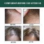 Многофункционален продукт за коса – растеж, заздравяване и сгъстяване, снимка 5