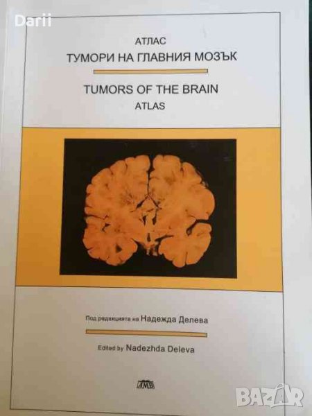 Тумори на главния мозък - Атлас -Надежда Делева, снимка 1