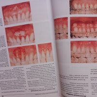 Естетична стоматология- Атлас - Джозеф Шмидседер, снимка 9 - Специализирана литература - 43919944