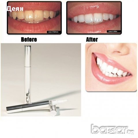 Избелваща писалка за зъби, снимка 4 - Други - 28345614