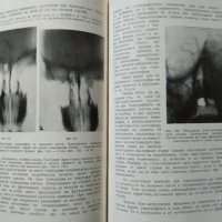 Томография на костите. Г. Хаджидеков, Б. Ботев 1957 г., снимка 3 - Специализирана литература - 27589751