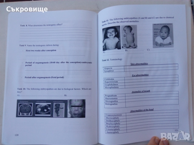 Medical Genetics - Practical Course for Medical Students - Медицинска генетика на английски език, снимка 9 - Специализирана литература - 43189866