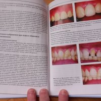 Естетична стоматология- Дейвид Бартлет, Пол Брантън, 2005год., снимка 3 - Специализирана литература - 43937311