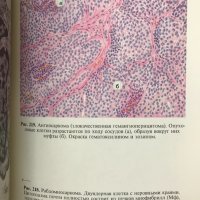 Патологическая анатомия. Атлас - В. В. Серов, Н. Е. Ярыгин, В. С. Пауков, снимка 5 - Специализирана литература - 28598429