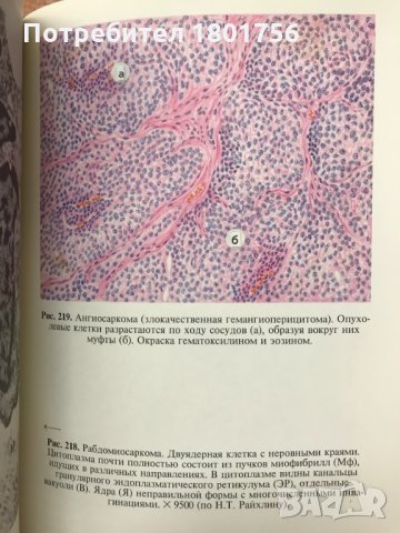 Патологическая анатомия. Атлас - В. В. Серов, Н. Е. Ярыгин, В. С. Пауков, снимка 5 - Специализирана литература - 28598429