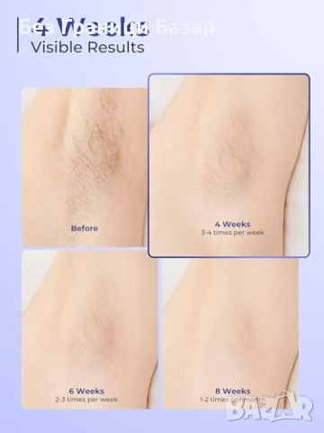 Нов IPL устройство за премахване на косми 999,900 импулса лице и тяло, снимка 5 - Други - 51996702