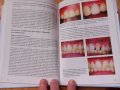 Естетична стоматология- Дейвид Бартлет, Пол Брантън, 2005год., снимка 3