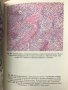 Патологическая анатомия. Атлас - В. В. Серов, Н. Е. Ярыгин, В. С. Пауков, снимка 5