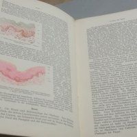 Медицински учебник. 1912г. Кожновенерически болести. Haut - und Geschlechtskrankheiten. Стара книга, снимка 7 - Специализирана литература - 33028157