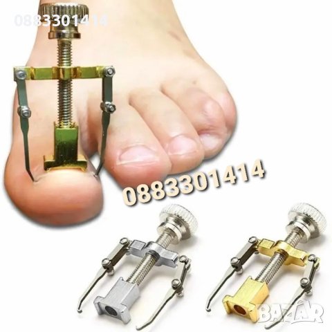 Уред за врастнали нокти 